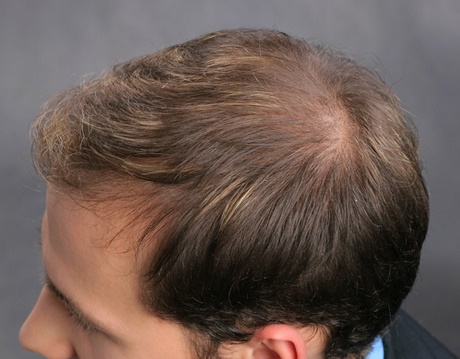 Kurze haare bei dünnen haaren