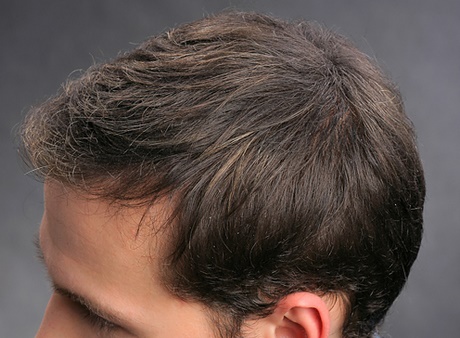 Kurze haare bei dünnen haaren