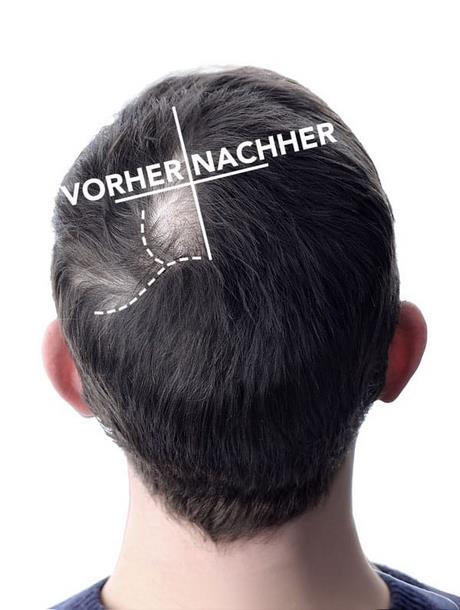 Männer haare wachsen lassen übergangsfrisur